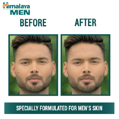 Himalaya Men Pimple Clear Neem Face Wash