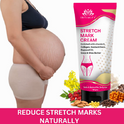 INTIMIFY Stretch Mark Removal Cream 
