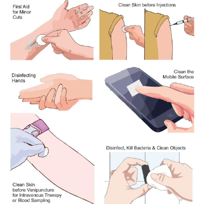 Sara+Care 100 Sterile Alcohol Swabs